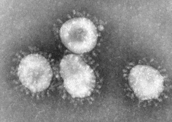 virus sars